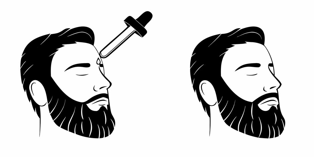 Man applying beard oil to soothe an itchy beard in a beard oil vs balm comparison.